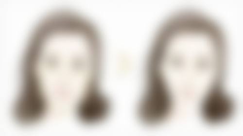 打什么牌子的瘦脸针比较好