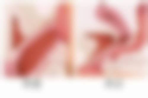 阴道紧缩手术成效怎么样