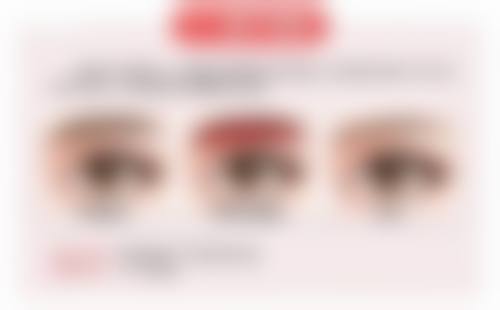 种植发际线200单位的相关情况