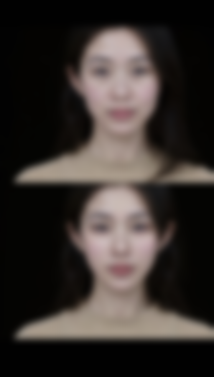 如何延长瘦脸成效