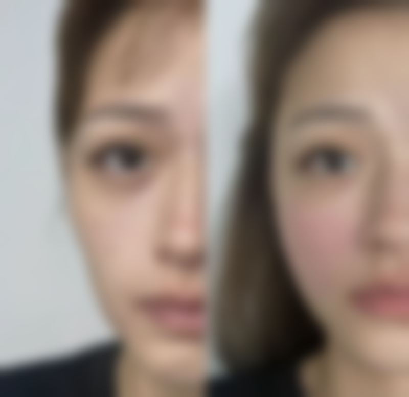 【厦门莫琳娜医疗美容门诊部特色项目:】