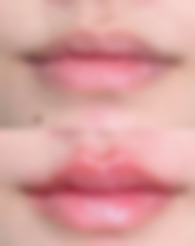 外阴、前庭部及阴道环部的萎缩性病变