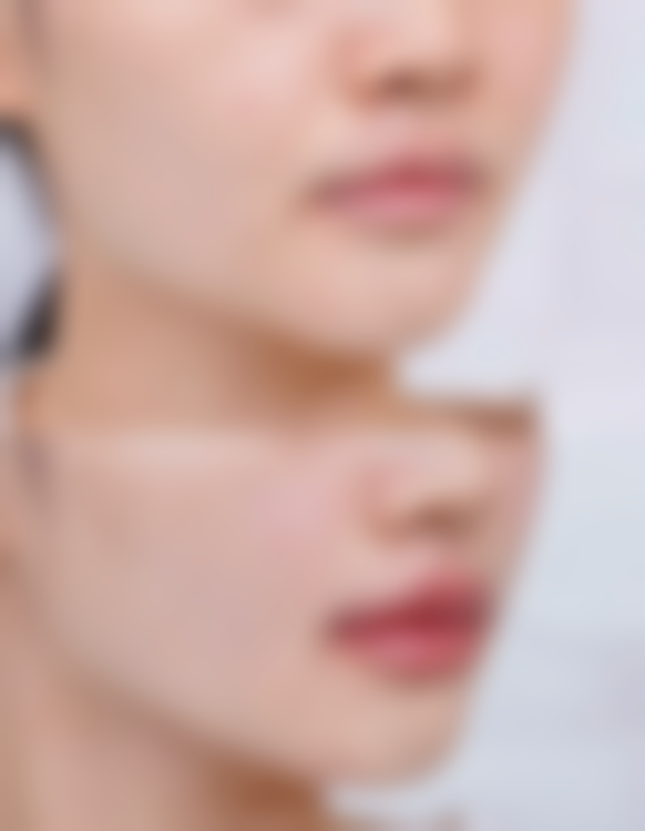 【辽阳新爱莉曼医疗美容特色项目:】