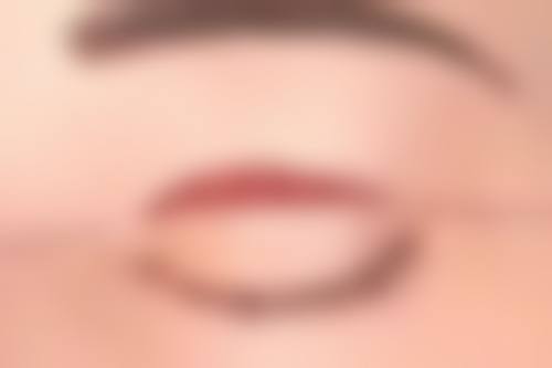 种植头发怎么收费