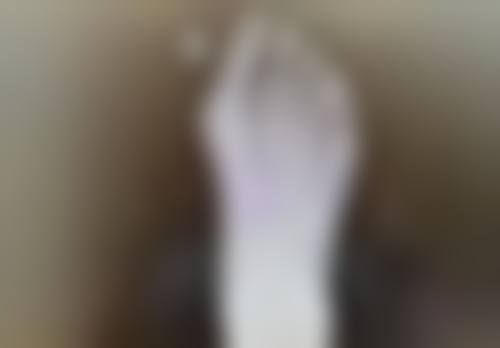 注射瘦脸针的价格