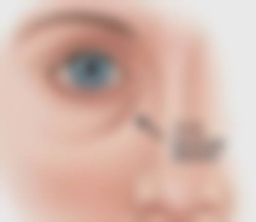 种植头发需要多少钱