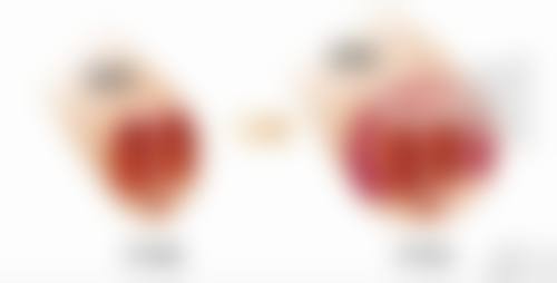 瘦脸针打完多久成效更明显