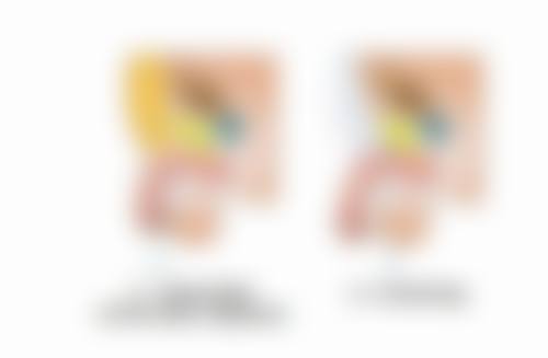 种植头发多少钱