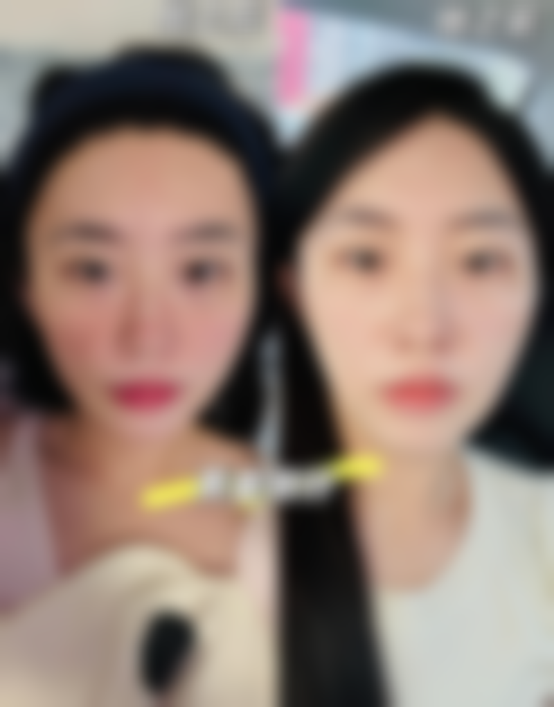 【佛山馨颜艺美整形医院患者口碑评价：】