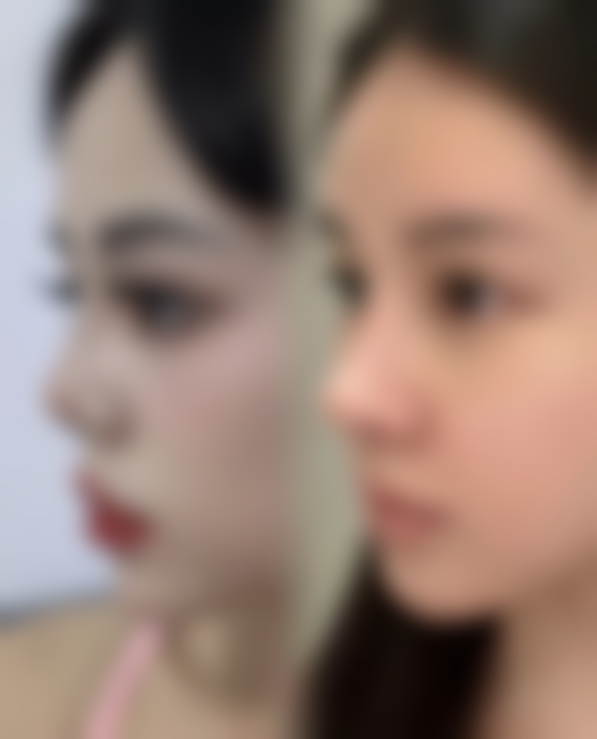 皮肤出现皱纹的原因：长期缺乏什么