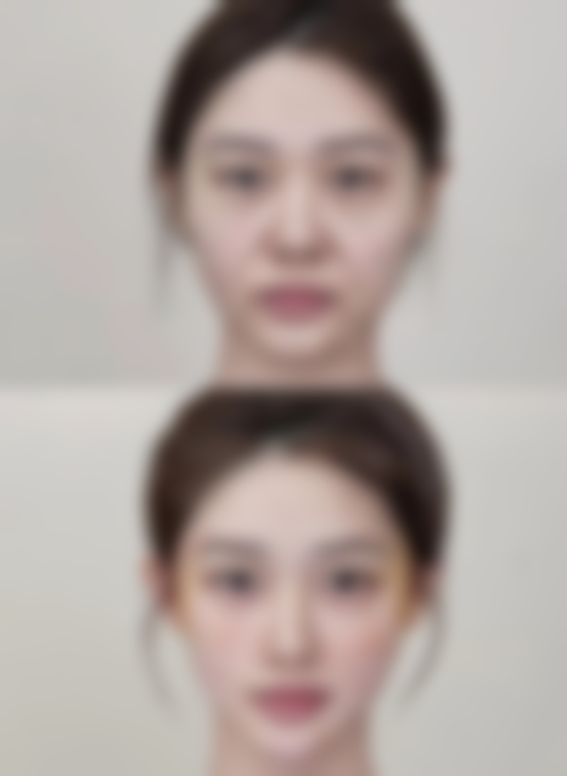 种植头发能维持几年