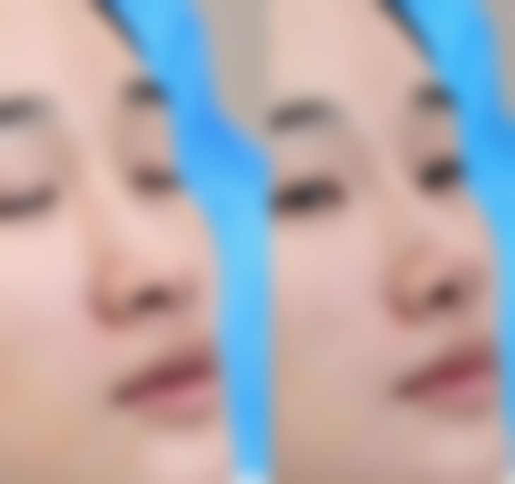 【瑞安友谊中医和西医结合医院美容整形科核心优势：】