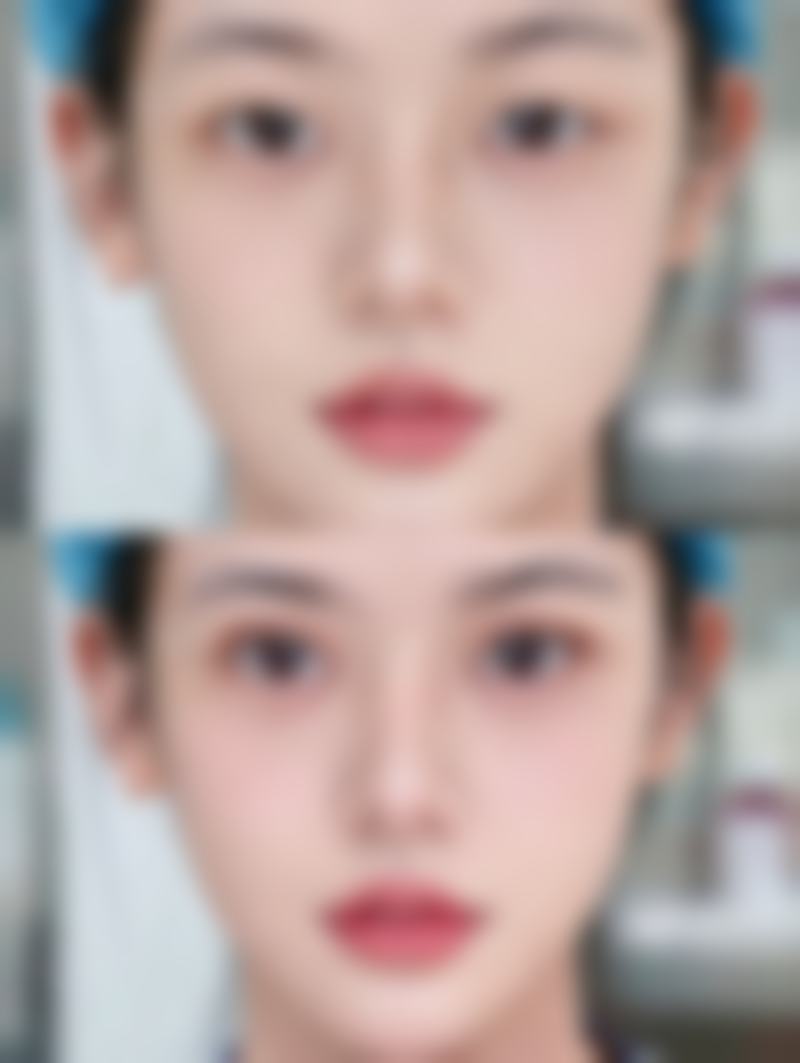 【佛山馨颜艺美整形医院特色项目：】