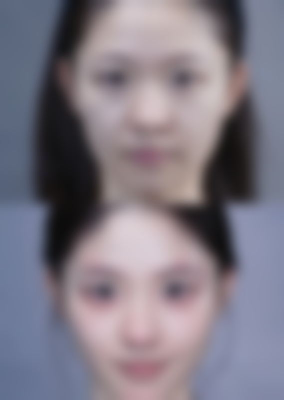 去除皱纹的药膏