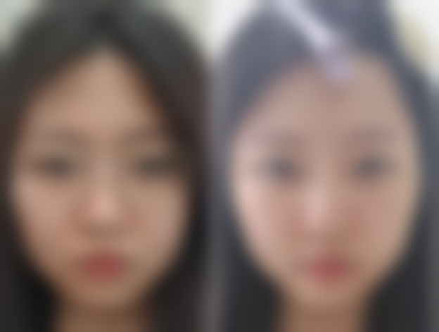 【广州金尚整形医院特色项目：】