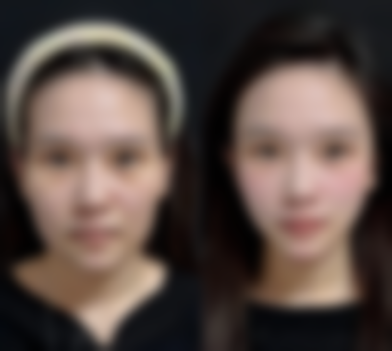 【佛山馨颜艺美整形医院怎么预约挂号?】