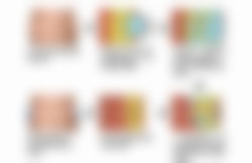 瘦脸针一般打50单位还是100单位