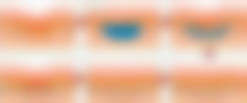 瘦脸针的作用好不好呢