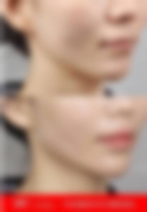 【义乌芙洛拉医疗美容怎么预约挂号?】