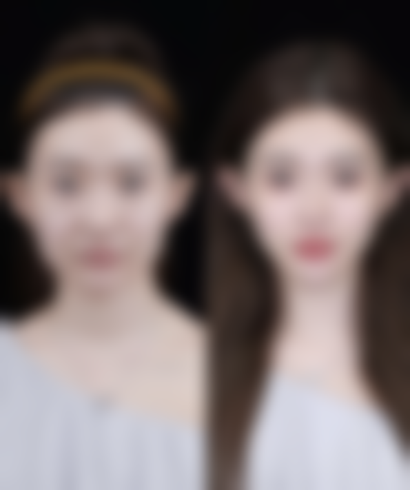 美容院的除皱针