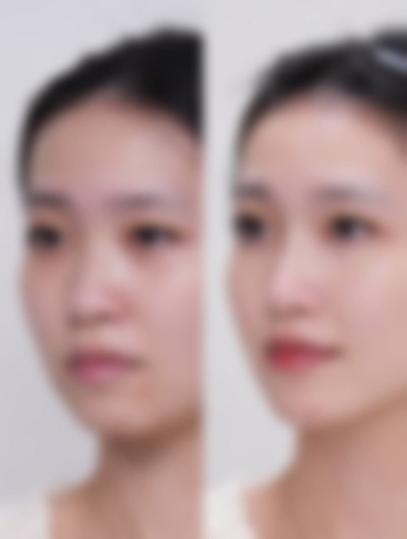 【大庆市邢立辉医疗美容参考价格表:】