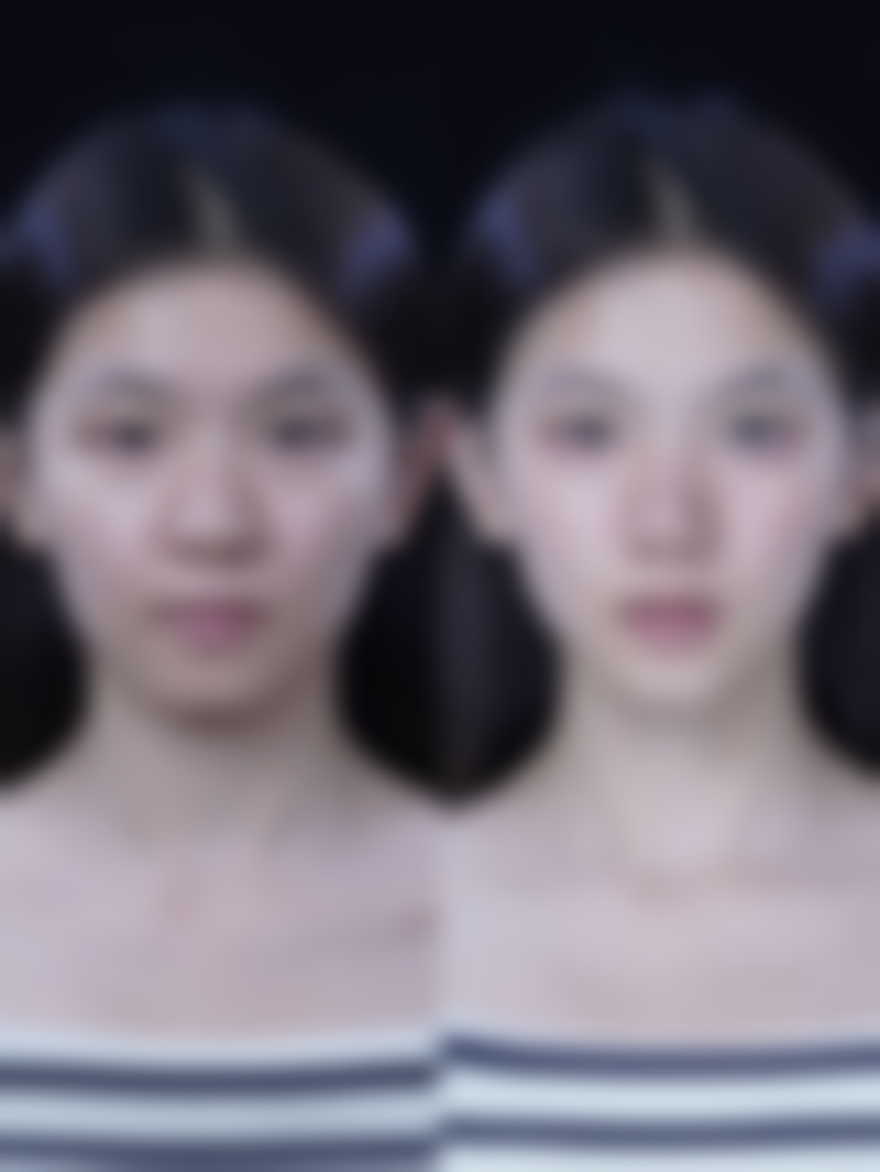 种植头发的成效维持时长