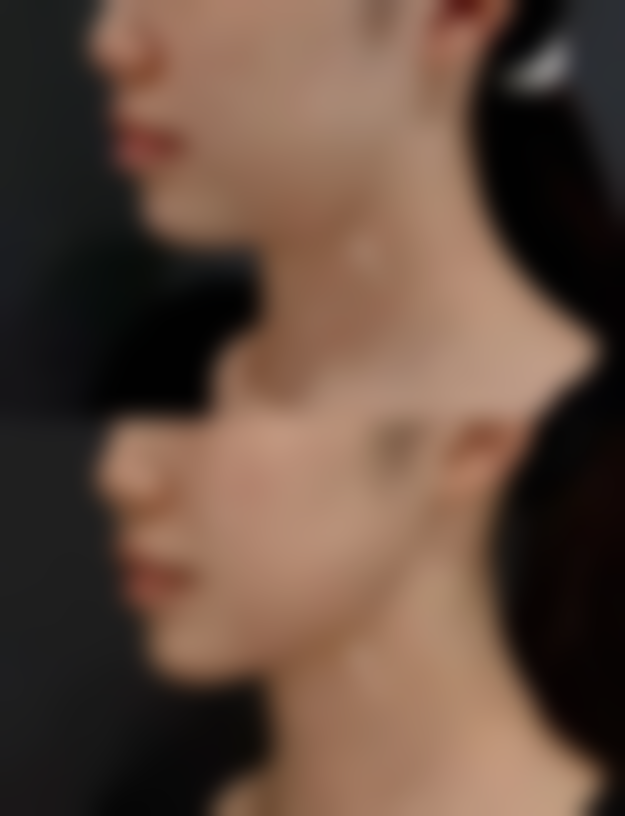 其他医疗美容方法