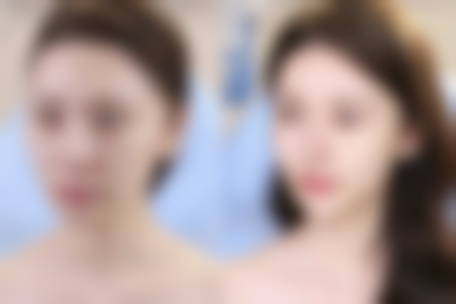 【十堰市人民医院(烧伤整形外科)怎么预约挂号?】