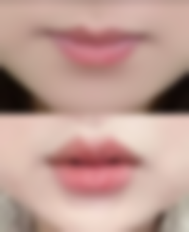 瘦脸针多久打一次成效至佳