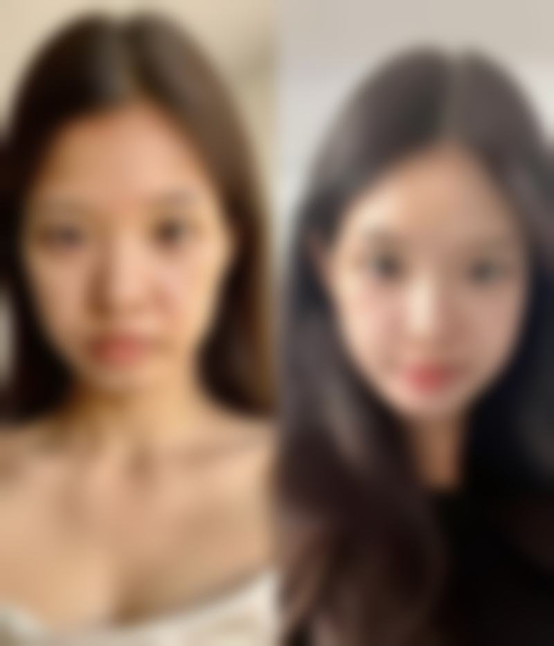 种植头发能自然生长吗