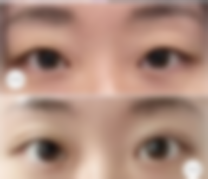 【王明月医生擅长项目】