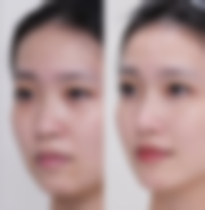 非医疗美容方法