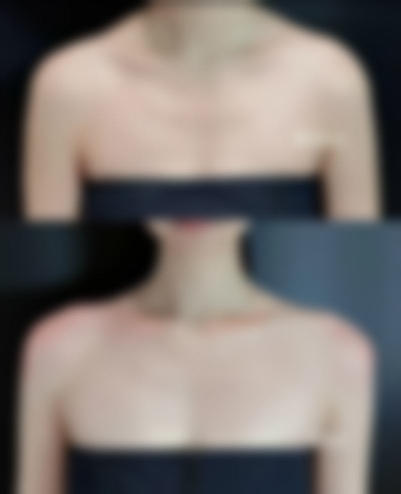 瘦脸针价格参考