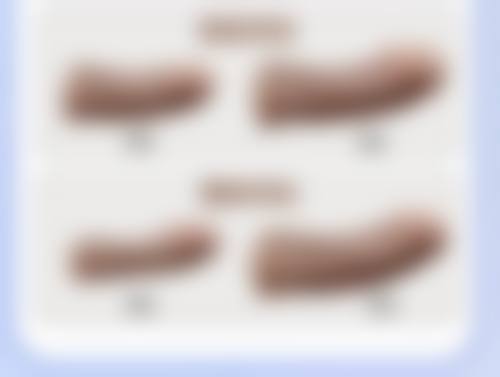 打瘦脸针饮食禁忌