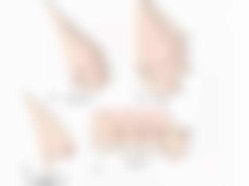 微针除皱成效好不好