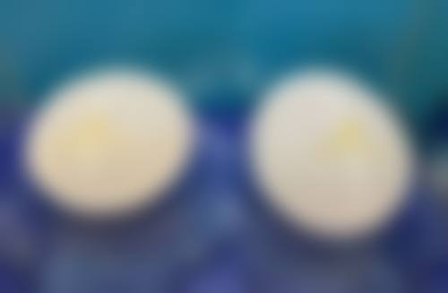 种植头发有什么好处