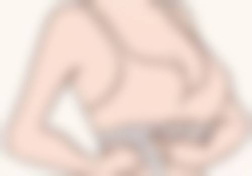 面上、中 1/3 皮肤松弛面部除皱术式选择