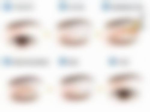 打瘦脸针之前注意哪些事项