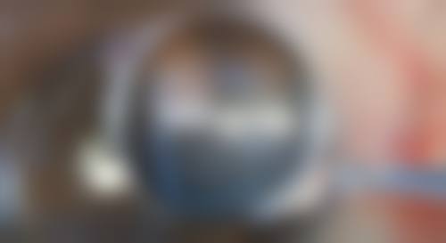 注射除皱有危险吗