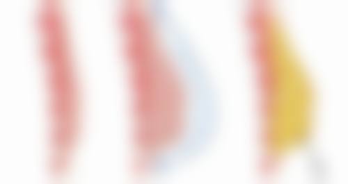 除皱针的成效维持时间