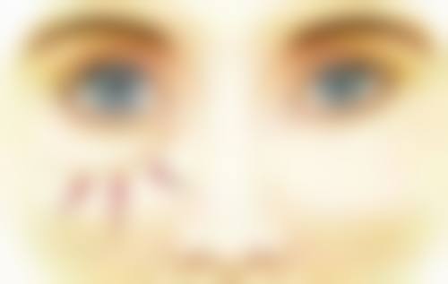 不剃发植发和剃发植发