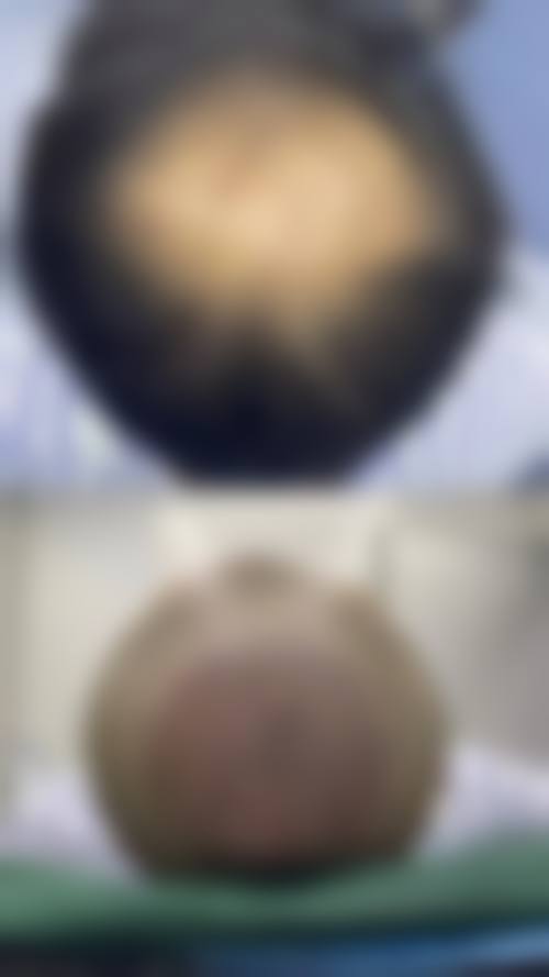 【成都武侯星范医疗美容参考价格表：】