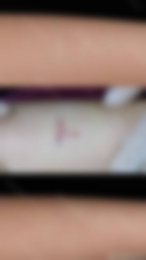 【太康县人民医院皮肤美容科参考价格表：】