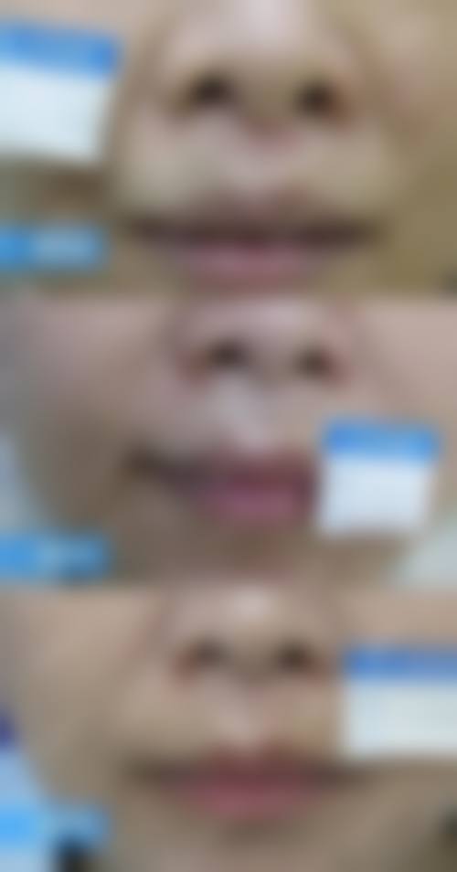 【成都武侯星范医疗美容特色项目：】