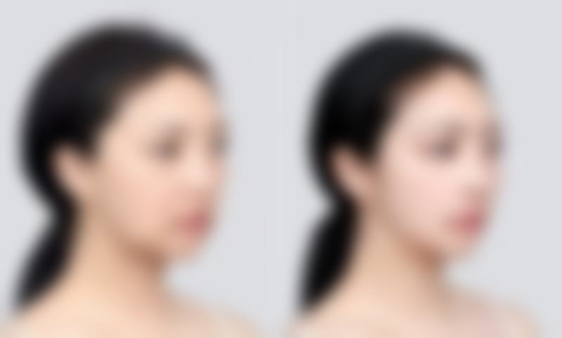 【无锡恒美整形医院参考价格表:】