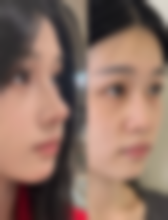 什么东西可以止痒