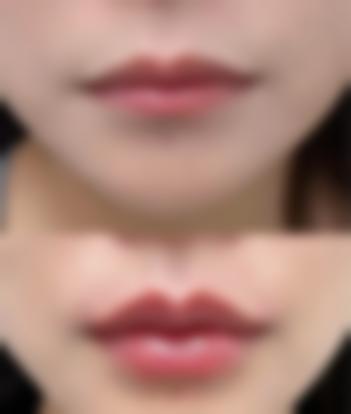 【广州百信医院私密整形科怎么预约挂号?】