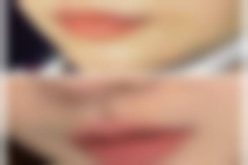 阴道紧缩后的成效