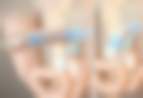 头发种植手术有危险吗——女性篇