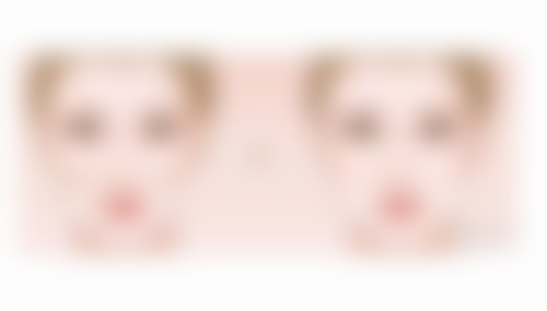 头发种植有没有副作用